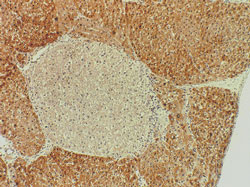 L-PK staining of the liver